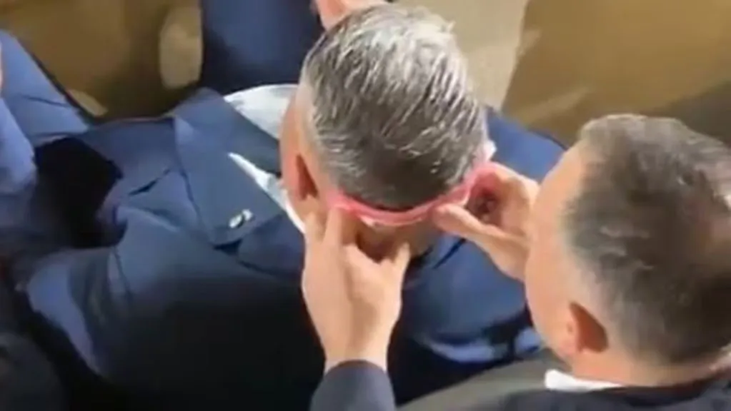 diagonal-tapia-secada-nuca